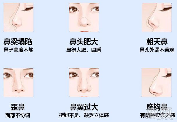 https://img.miyanlife.com/mnt/timg/190718/120K45243-2.jpg