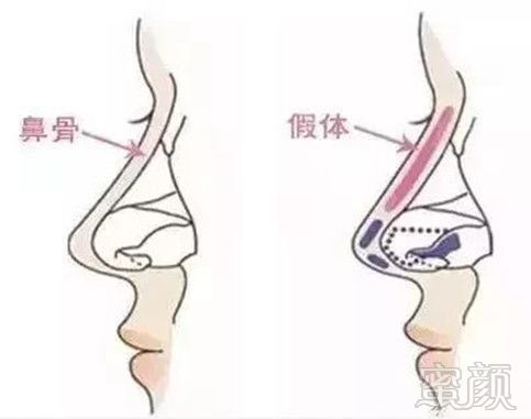 https://img.miyanlife.com/mnt/timg/190718/120K62J7-8.jpg