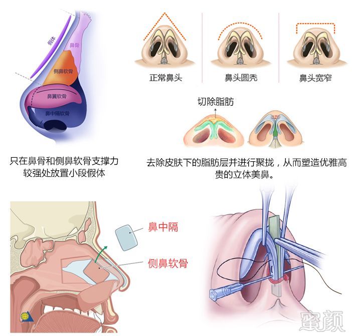 https://img.miyanlife.com/mnt/timg/190718/120K62R0-10.jpg