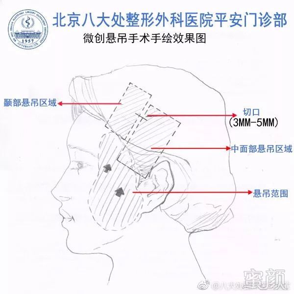 案例图片