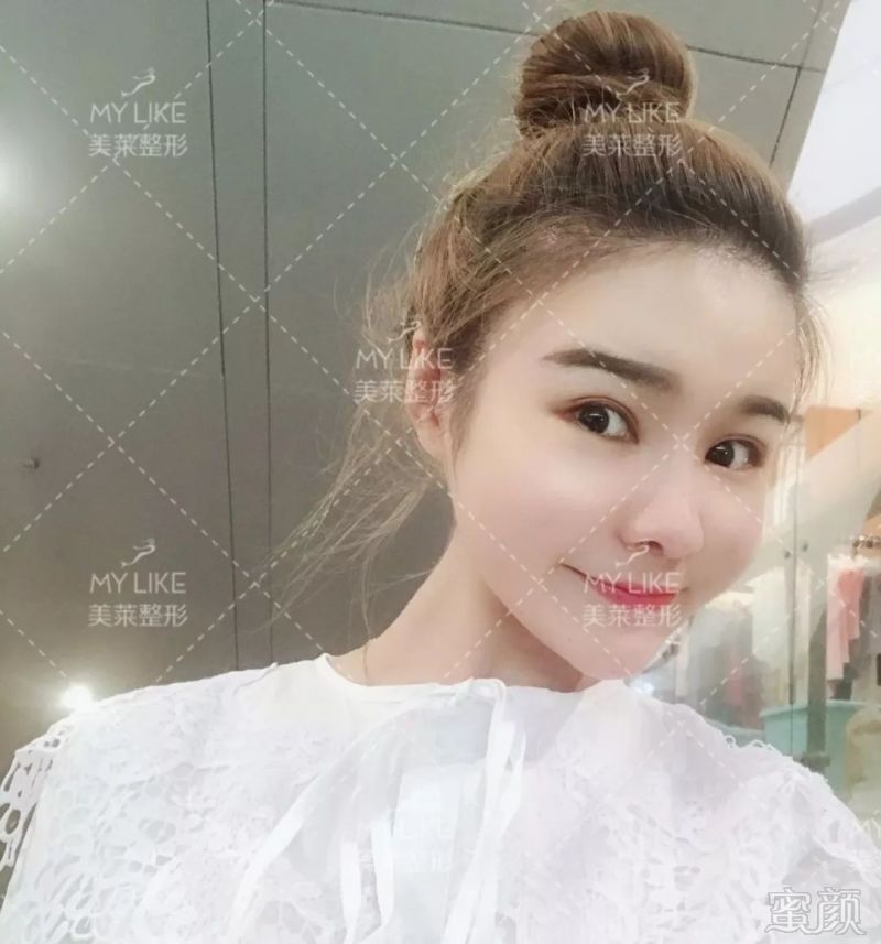 https://img.miyanlife.com/mnt/timg/190719/123549DH-7.jpg