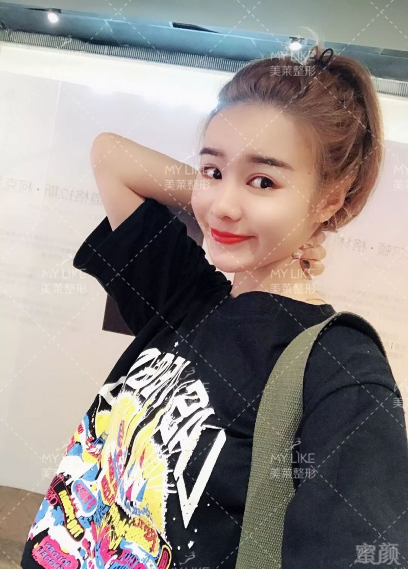 https://img.miyanlife.com/mnt/timg/190719/12355243J-13.jpg