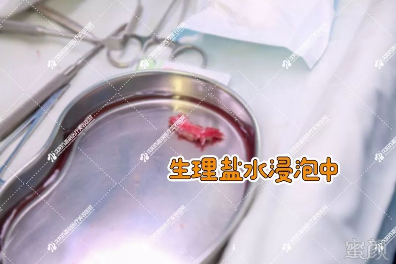 https://img.miyanlife.com/mnt/timg/190719/123H12242-5.jpg