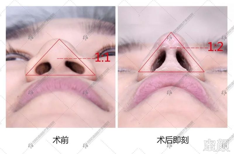 https://img.miyanlife.com/mnt/timg/190719/123I23S3-11.jpg
