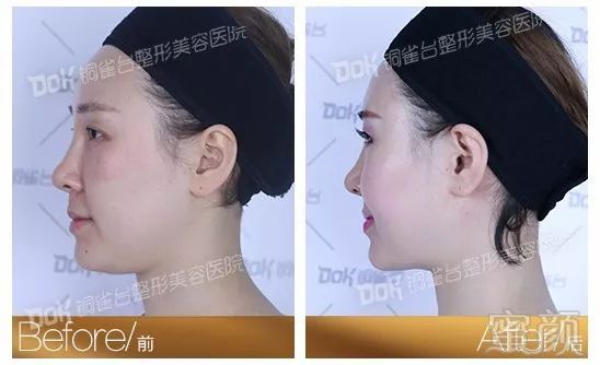 https://img.miyanlife.com/mnt/timg/190719/13100BJ3-17.jpg