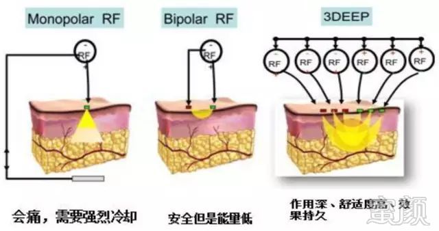 案例图片