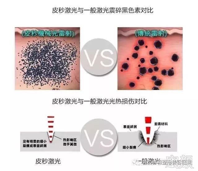 https://img.miyanlife.com/mnt/timg/190722/110G91135-2.jpg