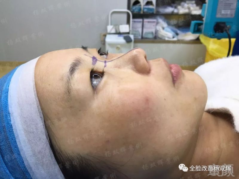 https://img.miyanlife.com/mnt/timg/190722/1133512349-0.jpg
