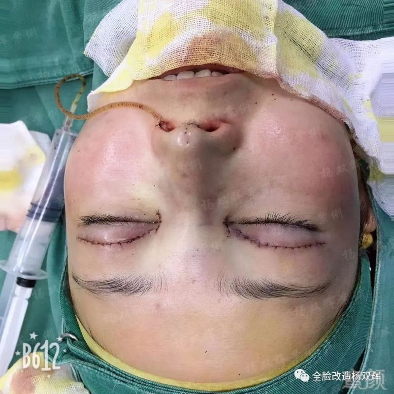 https://img.miyanlife.com/mnt/timg/190722/1133521933-1.jpg