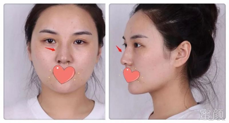 https://img.miyanlife.com/mnt/timg/190722/1155134E3-2.jpg