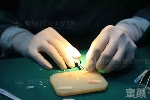 https://img.miyanlife.com/mnt/timg/190722/1156154215-2.jpg