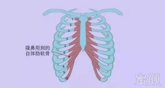 https://img.miyanlife.com/mnt/timg/190722/1156195624-5.jpg