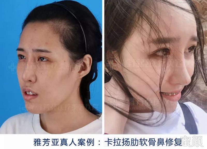 https://img.miyanlife.com/mnt/timg/190722/1156251148-10.jpg