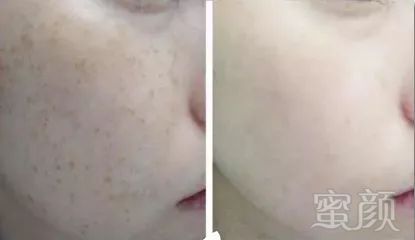 https://img.miyanlife.com/mnt/timg/190722/115P26216-9.jpg