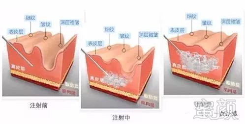https://img.miyanlife.com/mnt/timg/190722/12004044Z-9.jpg