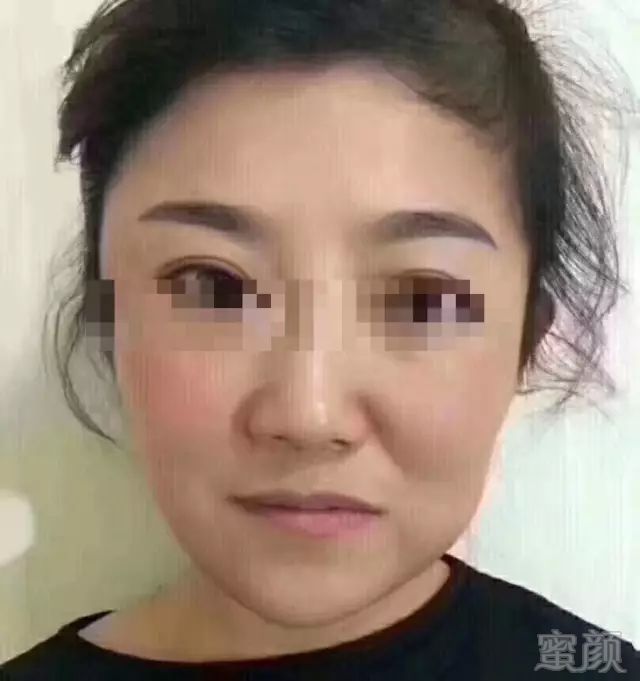 https://img.miyanlife.com/mnt/timg/190722/1201253458-6.jpg