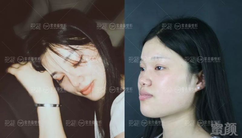 https://img.miyanlife.com/mnt/timg/190722/1203032354-0.jpg