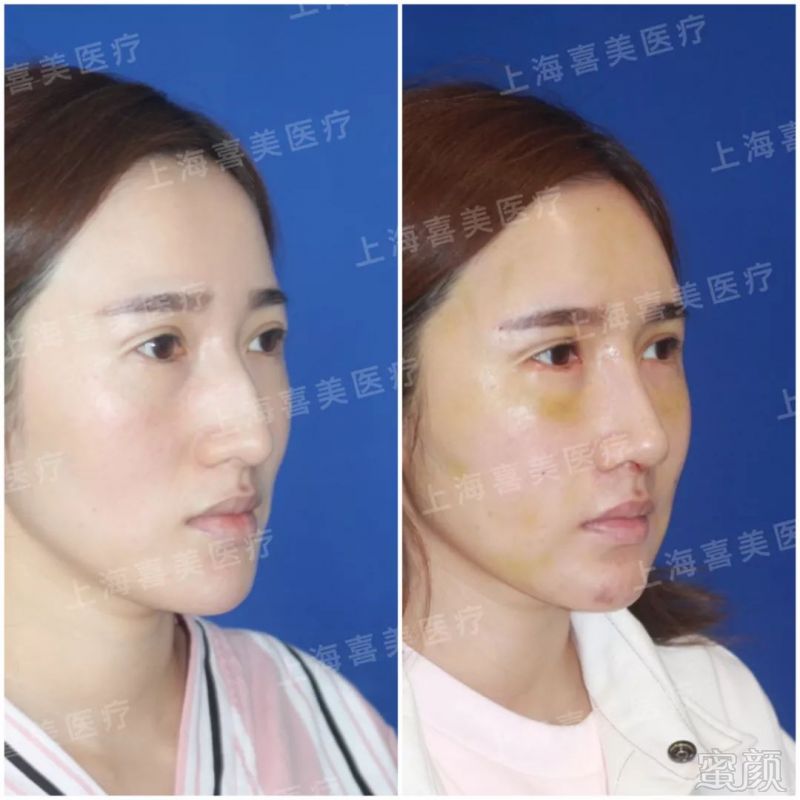https://img.miyanlife.com/mnt/timg/190722/1209393C1-3.jpg