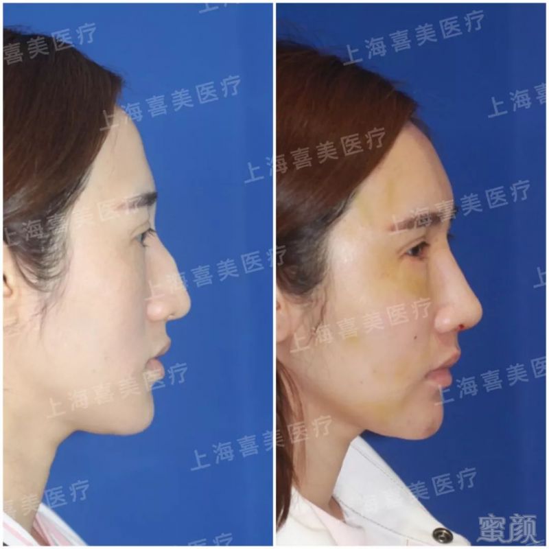 https://img.miyanlife.com/mnt/timg/190722/1209402U5-4.jpg