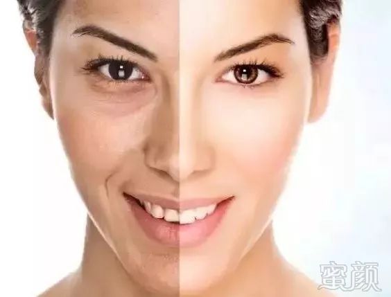 https://img.miyanlife.com/mnt/timg/190723/1126123953-0.jpg