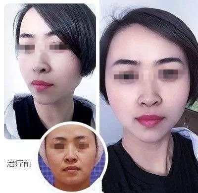 https://img.miyanlife.com/mnt/timg/190723/11524K600-10.jpg