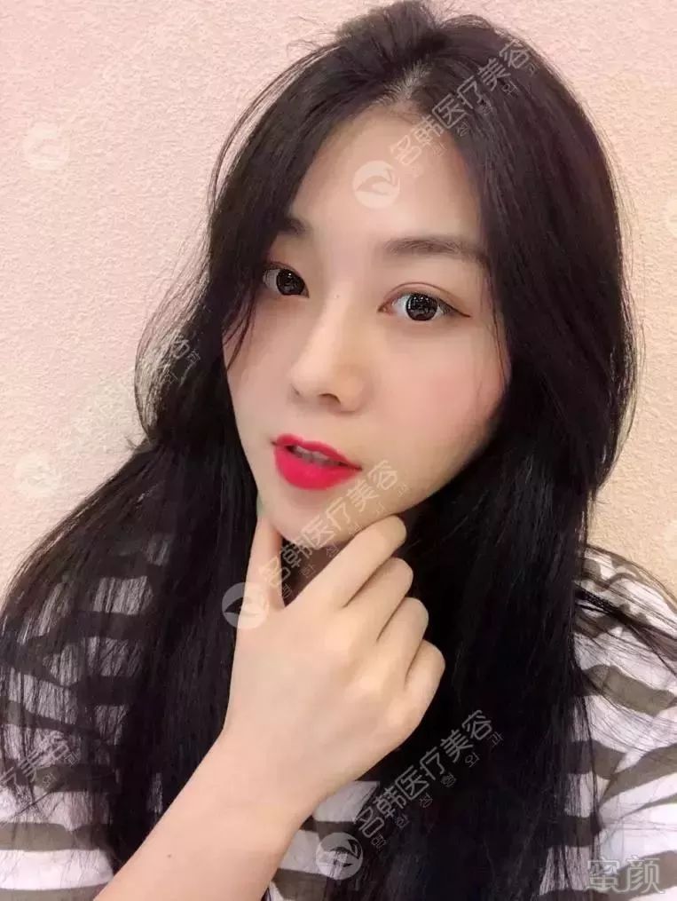 https://img.miyanlife.com/mnt/timg/190723/1200191026-7.jpg