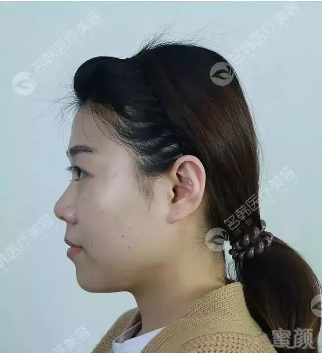 https://img.miyanlife.com/mnt/timg/190723/12001S312-3.jpg