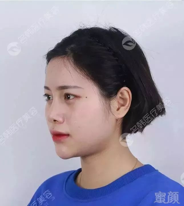 https://img.miyanlife.com/mnt/timg/190723/1200205212-10.jpg