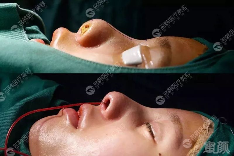https://img.miyanlife.com/mnt/timg/190723/120020A44-11.jpg