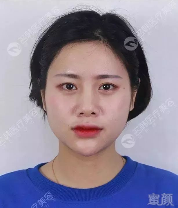 https://img.miyanlife.com/mnt/timg/190723/120020L13-9.jpg