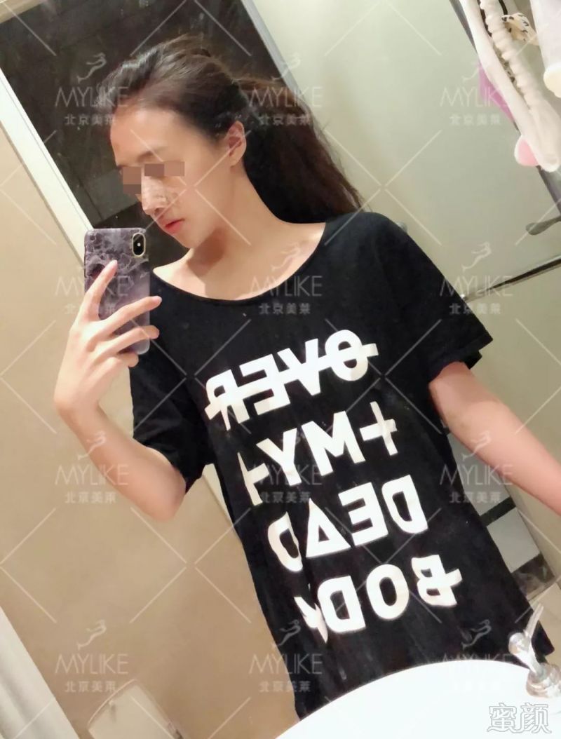 https://img.miyanlife.com/mnt/timg/190723/121545F18-1.jpg