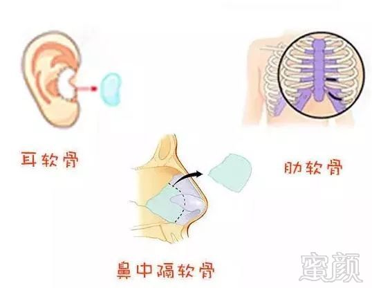 案例图片