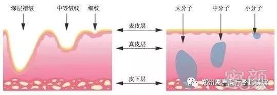 案例图片