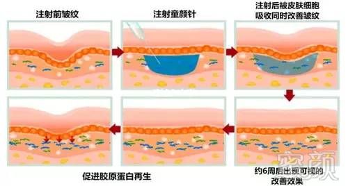 案例图片