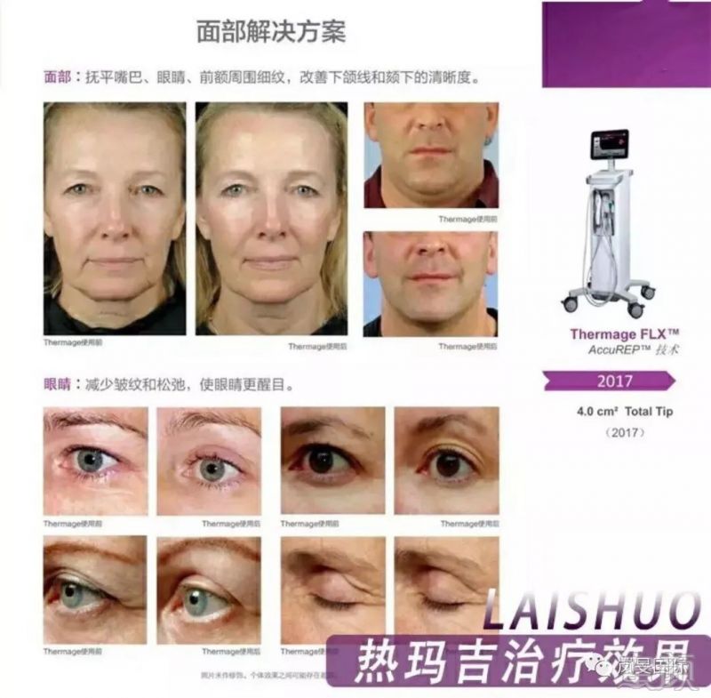 https://img.miyanlife.com/mnt/timg/190724/1315044395-4.jpg