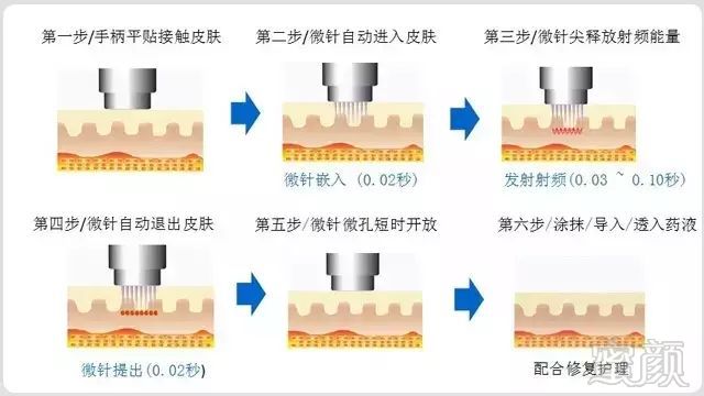 案例图片