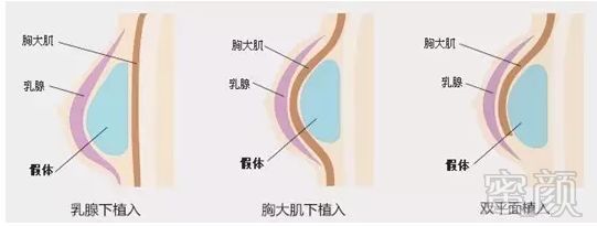 案例图片