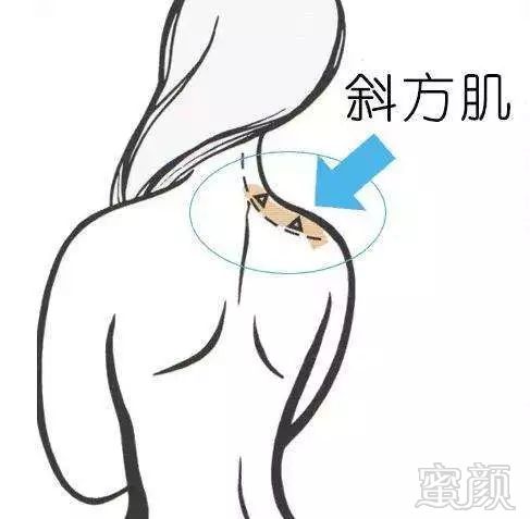 https://img.miyanlife.com/mnt/timg/190725/1219441S3-4.jpg