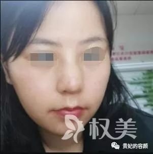 https://img.miyanlife.com/mnt/timg/190725/124512B48-2.jpg