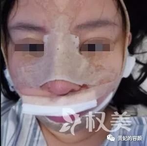 https://img.miyanlife.com/mnt/timg/190725/124512KB-1.jpg