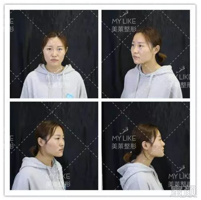 https://img.miyanlife.com/mnt/timg/190725/131414M57-2.jpg