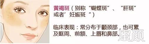 https://img.miyanlife.com/mnt/timg/190726/1129352192-8.jpg