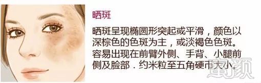 https://img.miyanlife.com/mnt/timg/190726/1129352H8-7.jpg