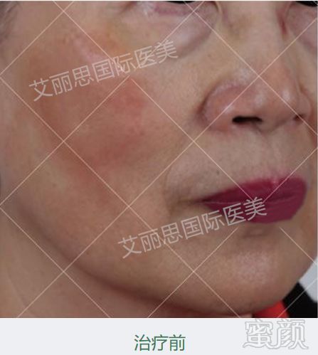https://img.miyanlife.com/mnt/timg/190726/11294612H-14.jpg