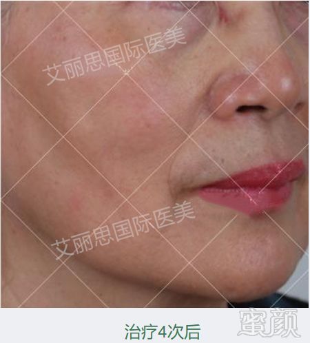 https://img.miyanlife.com/mnt/timg/190726/1129461V0-15.jpg
