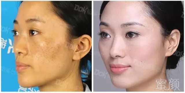 https://img.miyanlife.com/mnt/timg/190726/112K55593-15.jpg