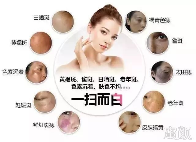 https://img.miyanlife.com/mnt/timg/190726/11352V0H-2.jpg