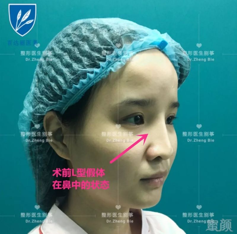 https://img.miyanlife.com/mnt/timg/190726/114P55F8-0.jpg