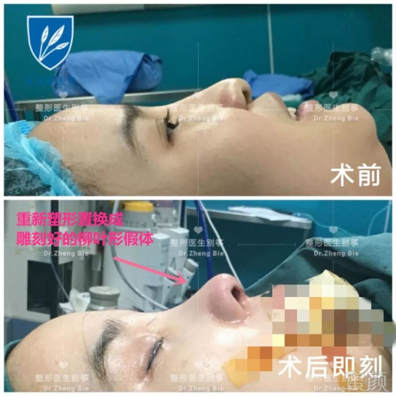 https://img.miyanlife.com/mnt/timg/190726/114P64N7-2.jpg