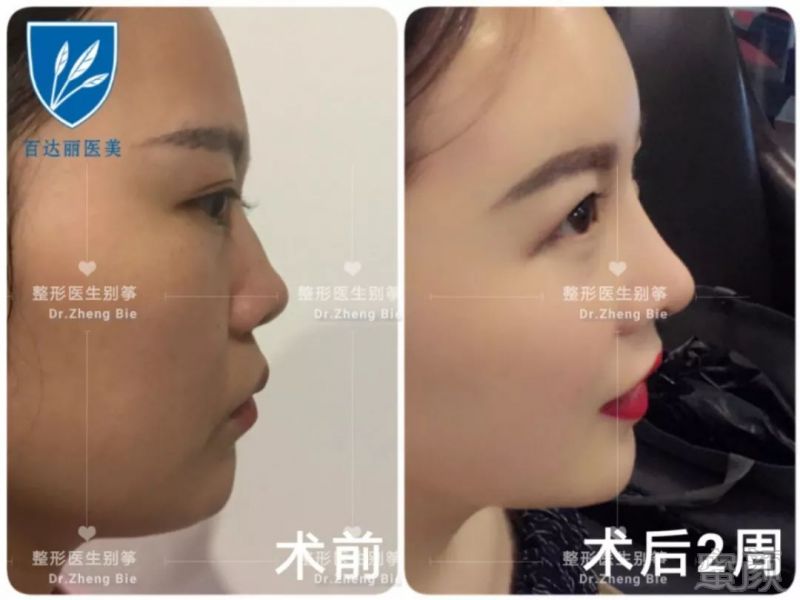 https://img.miyanlife.com/mnt/timg/190726/114PGR7-3.jpg
